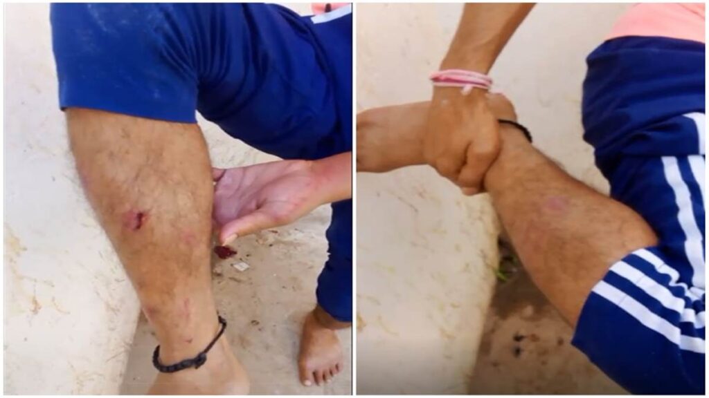 Prisoner assaulted in jail : जेल में कैदी से मारपीट, पीड़ित दुर्ग जेल में शिफ्ट, वीडियो वायरल