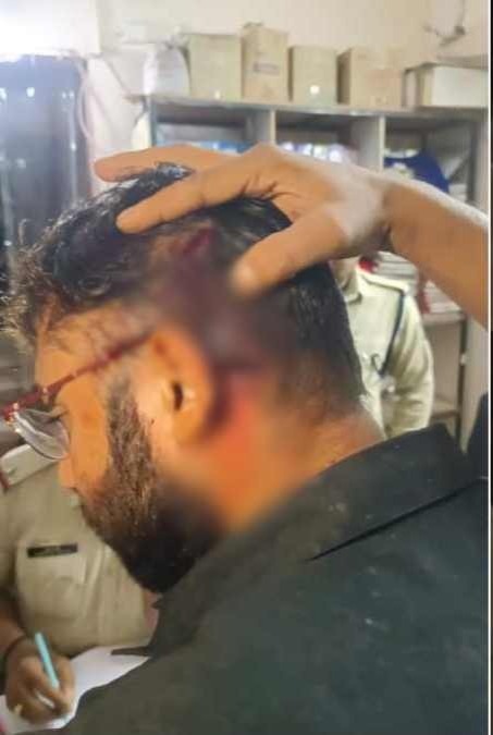 RAIPUR CRIME NEWS : राजधानी रायपुर के खम्हारडीह बदमाशों ने दिया हिंसक घटना को अंजाम,  पिता-पुत्र समेत 4 लोग घायल