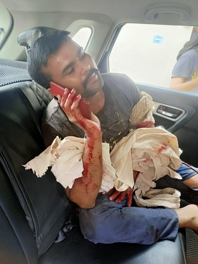 Chhattisgarh Pitbull Attack : रायपुर में प्रतिबंधित नस्ल के पिटबुल ने डिलीवरी बॉय पर जानलेवा हमला कर किया लहूलुहान, जान बचाने कार पर चढ़ा