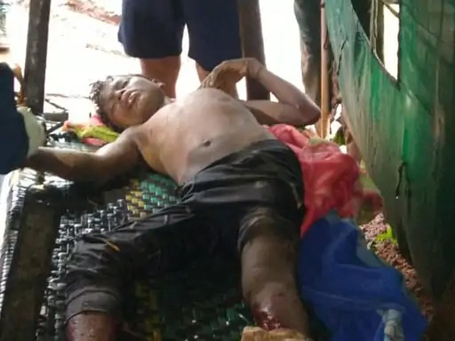 IED Blast In Bijapur : बीजापुर में IED ब्लास्ट में 10 साल मासूम की मौत, जवानों को नुकसान पहुंचाने नक्सलियों ने रखा था IED प्लांट, इलाज के दौरान तोड़ा दम