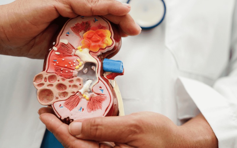 किडनी ट्रांसप्लाट की सुविधा