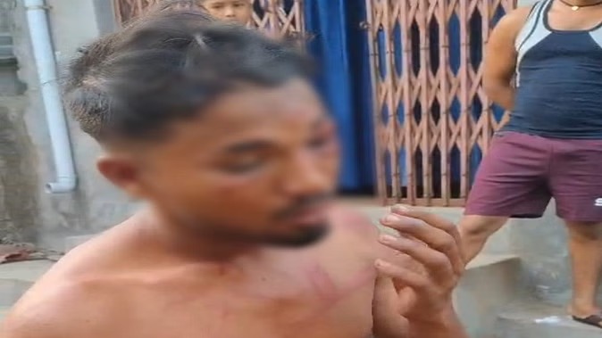 Sakti Dalit Youth : इंसानियत शर्मसार, छत्तीसगढ़ में दलित युवक की निर्वस्त्र कर बेरहमी से पिटाई, पानी के लिए भी तरसाया