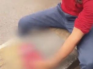 Raipur youth finger cut video: रायपुर में युवक ने गौ-माता की जय बोलकर उंगली काटी, वीडियो वायरल – सरकार से ‘राज्य माता’ घोषित करने की मांग