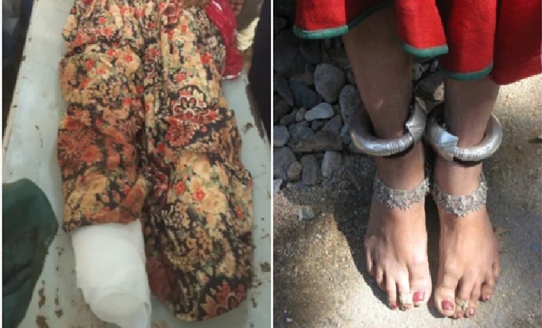 Brutality : दरिंदगी की हद…! मजदूरी के बहाने महिला को ले गया जंगल…दोनों पैर काटकर डेढ़ किलो चांदी के कड़े लूटे…यहां देखें VIDEO