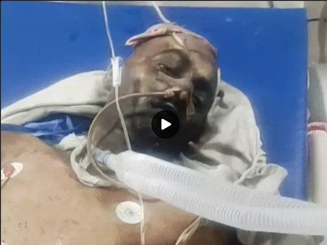 Fire SMS Hospital : बड़ी खबर…! ICU वॉर्ड में लगी भीषण आग…8 लोगों की दर्दनाक मौत…अस्पताल में मची चीख-पुकार…यहां देखें