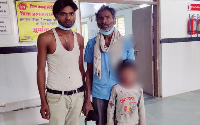 Cornea Damage: A firecracker exploded in a child's hand on Diwali...! He lost his eyesight.