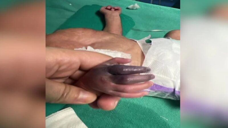 Private Nursing Homes: Negligence of doctors and staff at the nursing home! An infant was given an injection incorrectly...now the newborn's hand will have to be amputated.