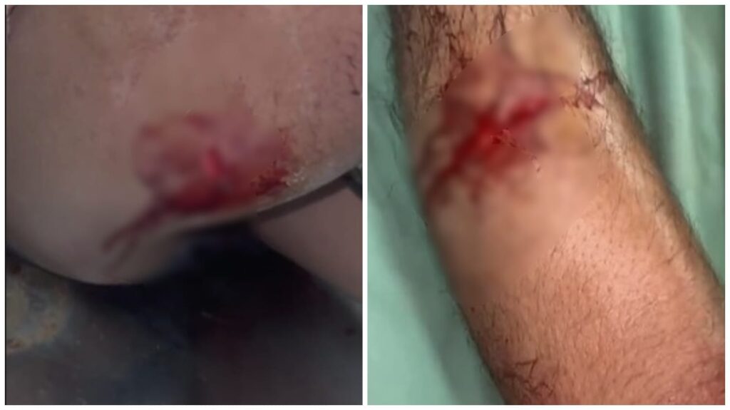 Molestation of a Girl : रायपुर में हाई अलर्ट के बीच चाकूबाजी…! युवती से छेड़छाड़…भाई ने रोका तो चाकू से किया हमला…यहां देखें Video