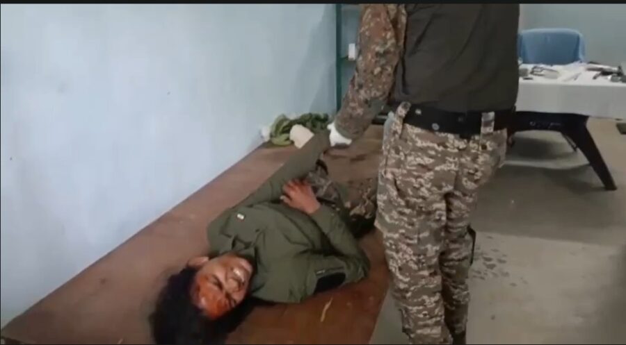 Soldier Injured in Sukma : नक्सली IED की चपेट में आई महिला कांस्टेबल…! हालत स्थिर लेकिन चोट गंभीर..यहां देखें VIDEO