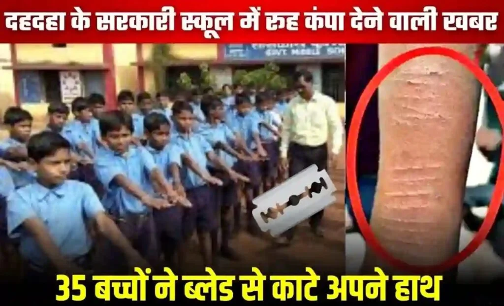Blade Incident at School : धमतरी से रूह कंपा देने वाली खबर…! 1-2 नहीं…35 बच्चों ने ब्लेड से काट लिए अपने हाथ…शॉकिंग कारण जानकर विभाग और प्रशासन में हड़कंप