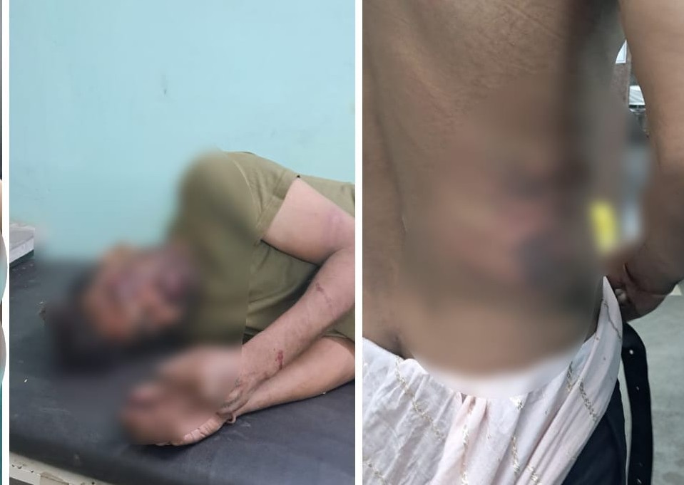 Army Attack : आर्मी जवानों पर जानलेवा हमला…! चखना सेंटर संचालकों ने चाकू-रॉड से किया वार…3 घायल