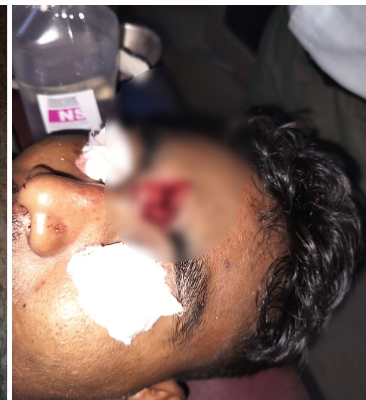 Protest Violence : सक्ती में बवाल…बच्ची की मौत के बाद भड़का गुस्सा…ईंट-पत्थर से हमला आरक्षक का फूटा सिर