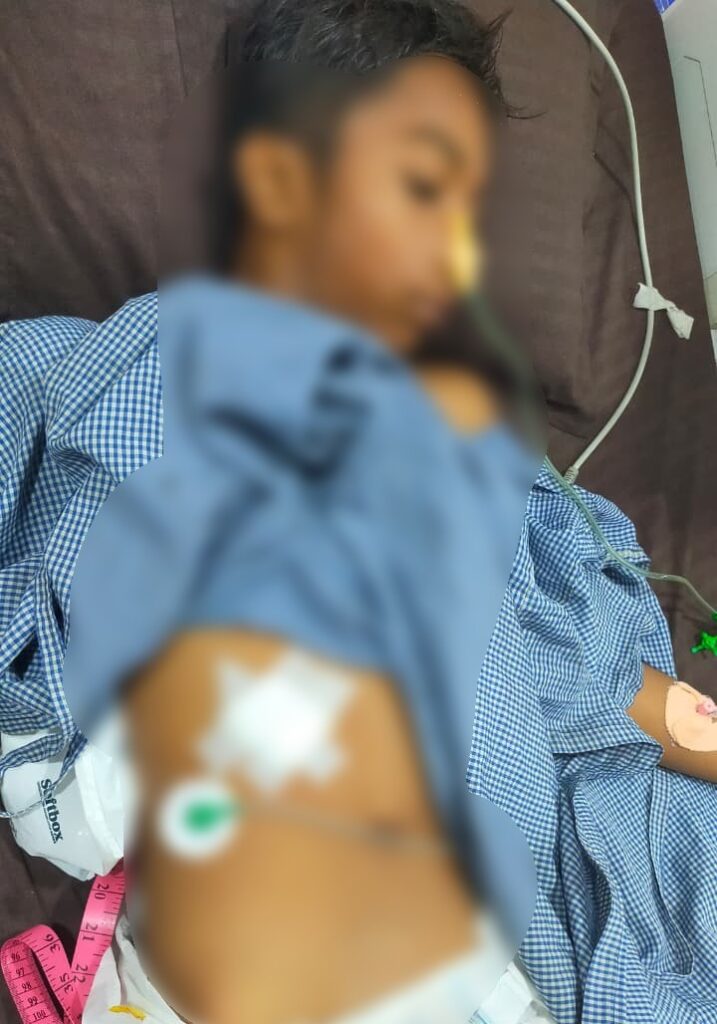 Knife Attack : ब्रेकिंग…रायपुर में चाकूबाजी से सनसनी…! पुरानी रंजिश में युवक पर जानलेवा हमला…यहां देखें CCTV में कैद खौफनाक वारदात