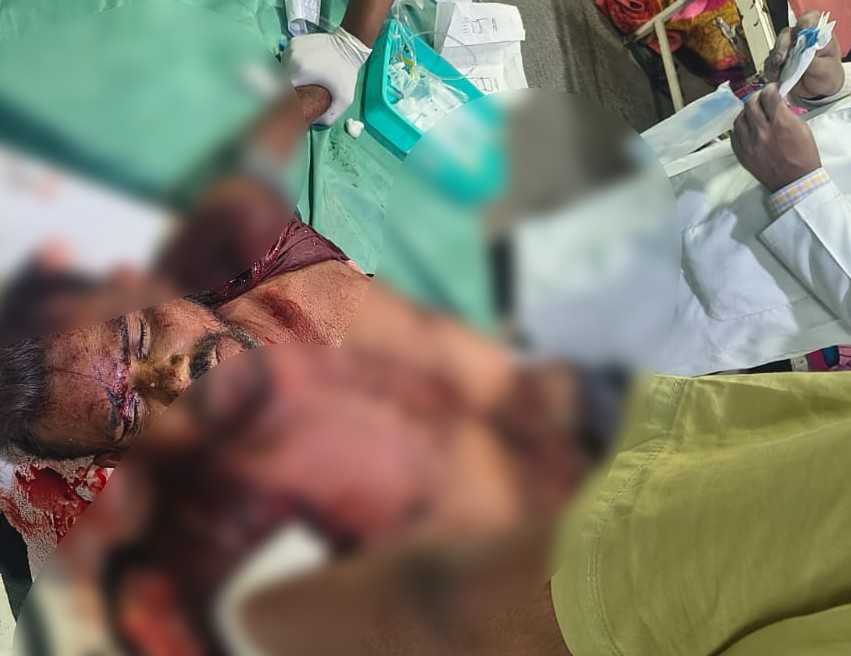 Train Accident : रायपुर में बड़ा ट्रेन हादसा…! प्लेटफॉर्म के पास मिला लहूलुहान युवक…शरीर से कटकर अलग हुआ एक हाथ