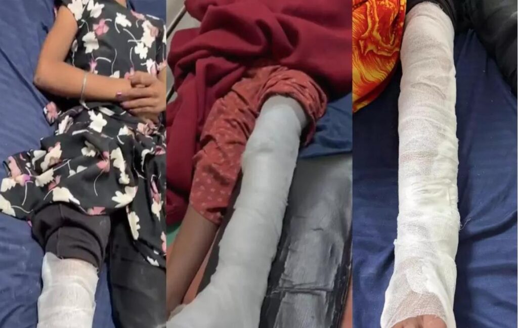 Wall Collapse : रायपुर में JCB से दीवार तोड़ते समय बड़ा हादसा…! खेल रहीं बच्चियां मलबे में दबीं…3 मासूम घायल