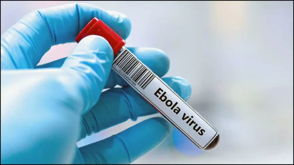 Ebola Virus: दुर्ग में इबोला संदिग्धों को लेकर अलर्ट…स्वास्थ्य विभाग ने बढ़ाई निगरानी